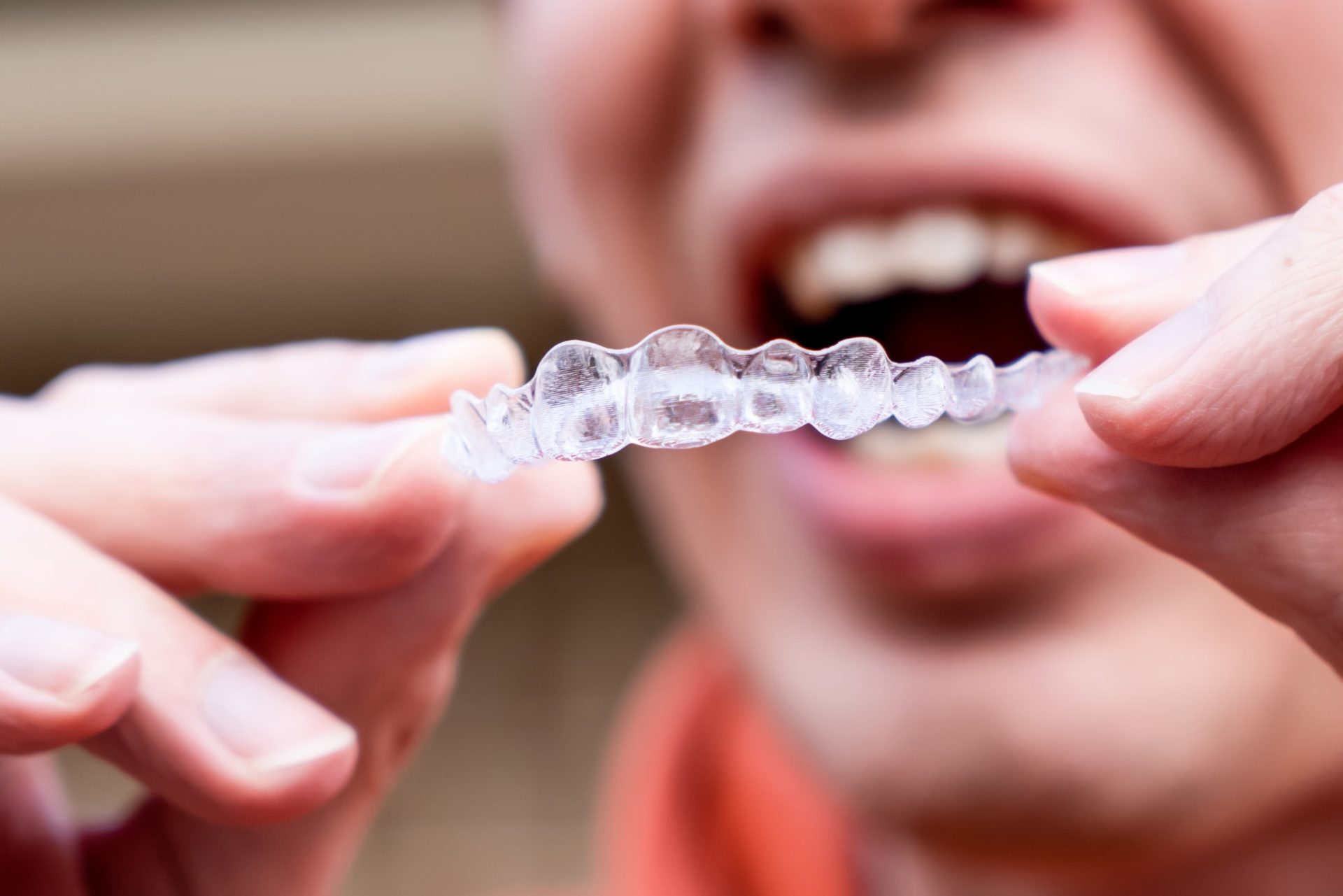 Man holds put on invisible braces. Invisalign plastic removable braces